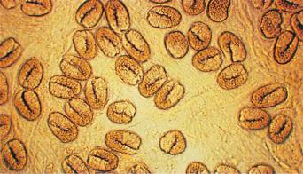 Fig. 2.26, Eggs of Strongyloides fülleborni in faeces.