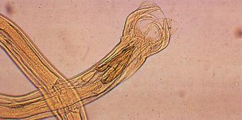 Fig. 2.29, Adult male Trichostrongylus .