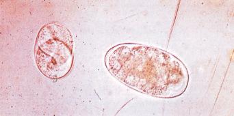 Fig. 2.30, Eggs of Trichostrongylus and Strongyloides stercoralis in faeces.