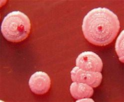 Fig. 2.05, Burkholderia pseudomallei , the cause of melioidosis.