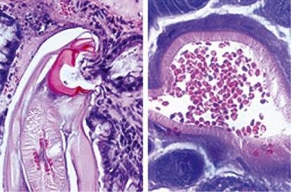 Fig. 2.09, Adult Ancylostoma attached to intestinal mucosa (left) with ingested red blood cells visible in the intestine of the worm in cross-sectional view (right).