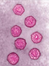 Fig. 3.1, Poliomyelitis virus.