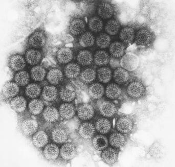 Fig. 3.11, Rotavirus.