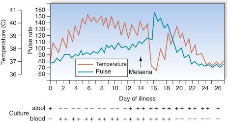 Fig. 3.15, Temperature chart in typhoid.