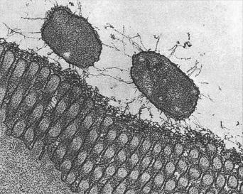 Fig. 3.22, Enterotoxigenic Escherichia coli adhering to the brush border of the (intact) human intestinal mucosa.