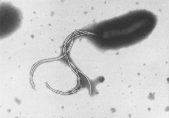 Fig. 3.32, Helicobacter pylori.
