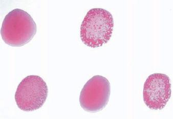Fig. 3.34, Rose Bengal test for brucellosis.