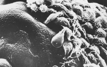 Fig. 3.47, Giardia intestinalis in jejunal biopsy.