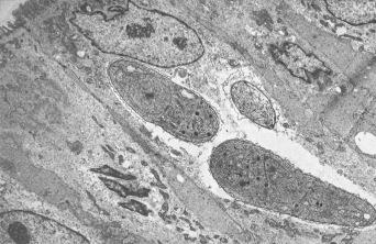 Fig. 3.51, HIV-associated Cystisospora belli in mucosal cell of the ileum.