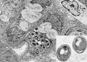 Fig. 3.59, Mature spores of Enterocytozoon bieneusi in human jejunal enterocyte.