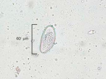 Fig. 3.61, Ovum of Enterobius vermicularis .