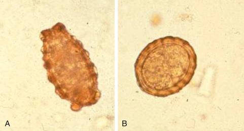 Fig. 3.68, Unfertilized and fertilized egg of Ascaris lumbricoides.