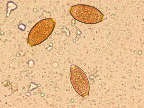 Fig. 3.77, Ova of Trichuris trichiura.