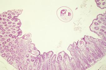 Fig. 3.78, Cross-section of Trichuris trichiura associated with caecal tissue.