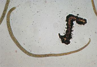 Fig. 3.90, Adult female Trichinella spiralis .