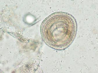 Fig. 3.97, Embryonated Toxocara ovum.