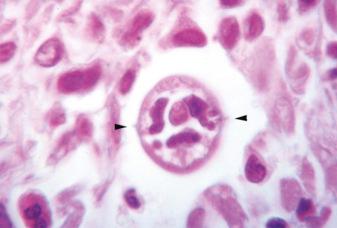 Fig. 3.99, Toxocara canis migrating through the lung.