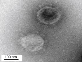 Fig. 4.1, Electron micrograph of severe acute respiratory syndrome-coronavirus (SARS-CoV).