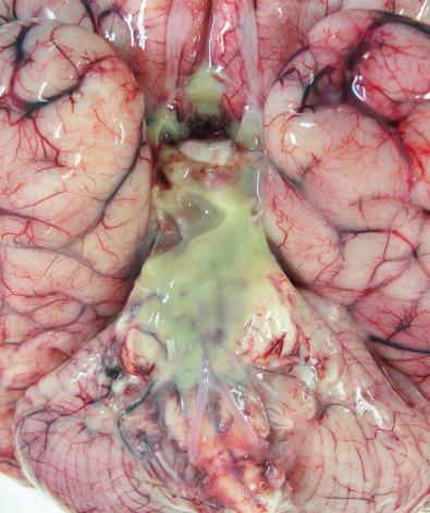 Fig. 23.13, Basilar fungal meningitis due to C. immitis infection may result in thick, greenish exudates.