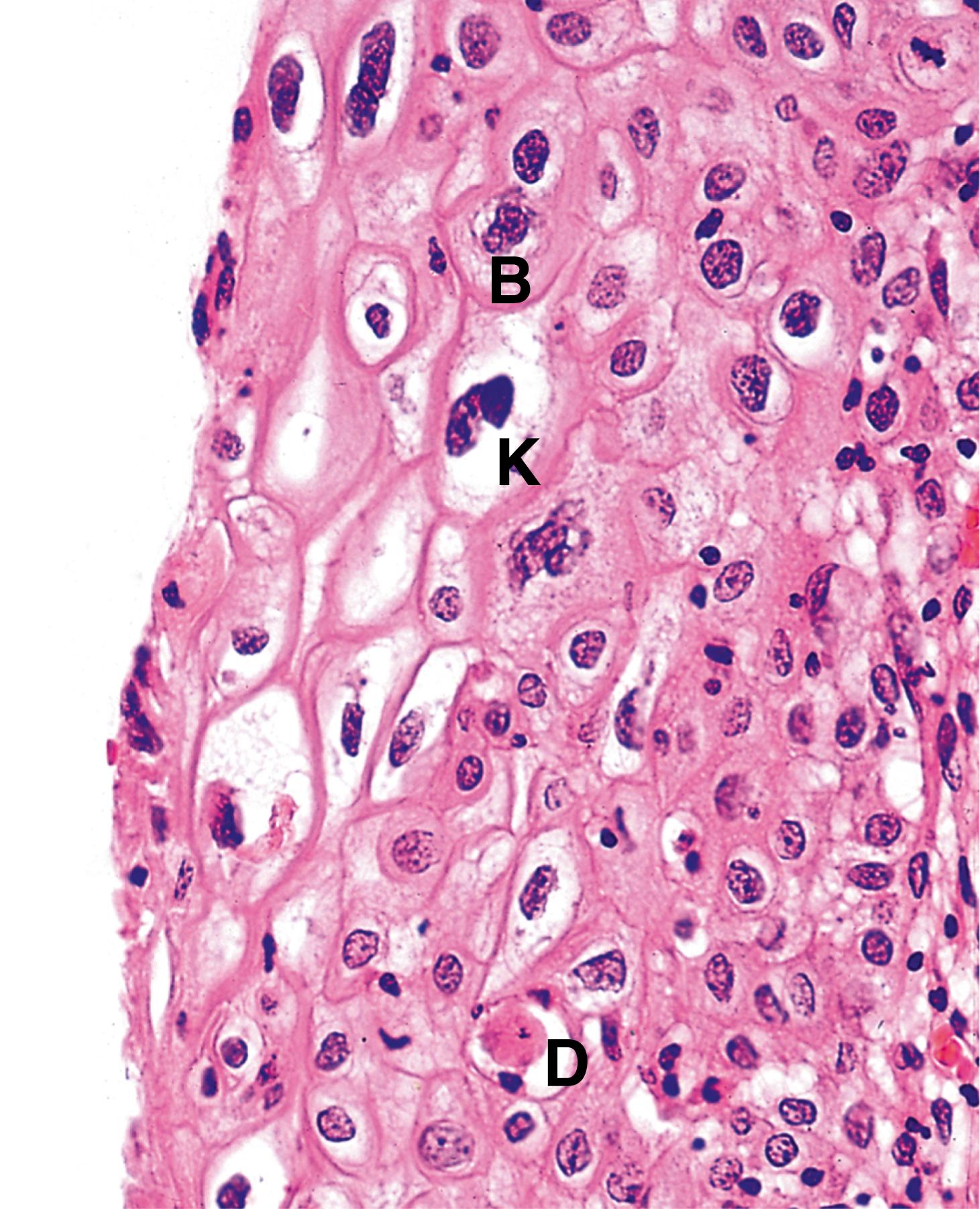 Fig. 5.14, Human papillomavirus (HP).