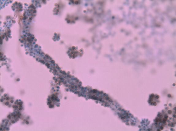 Figure 26-12, In addition to the floret type of conidiation, Sporothrix also produces conidia along both sides of the hyphum in a “sleeve” morphology. There is a variable amount of dark pigment that may occur in the cell walls of Sporothrix species, which usually increases with the age of the culture. Lactophenol cotton blue, 1000 × magnification.