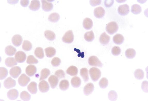 Figure 26-14, The small size and the “bowling pin” appearance of the yeasts present in the blood of this patient with an intravascular access catheter infection caused by M. furfur are distinctive enough to afford a genus-level identification. Giemsa stain, 1000 × magnification.