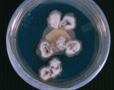 Figure 26-7, The white floccose colonies of H. capsulatum on potato-dextrose agar without blood.