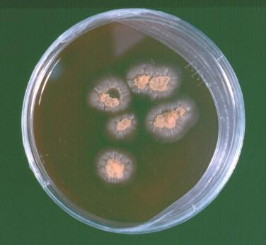 Figure 26-8, The colonies of H. capsulatum may appear waxy and more yeastlike on blood-containing media, such as this chocolate agar.