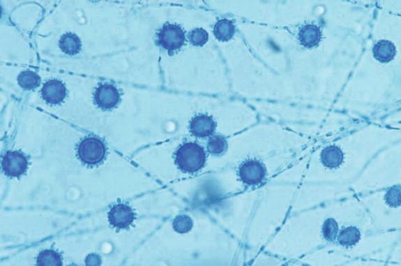 Figure 26-9, The spherical, tuberculate macroconidia are characteristic of H. capsulatum. Lactophenol cotton blue preparation, 400 × magnification.