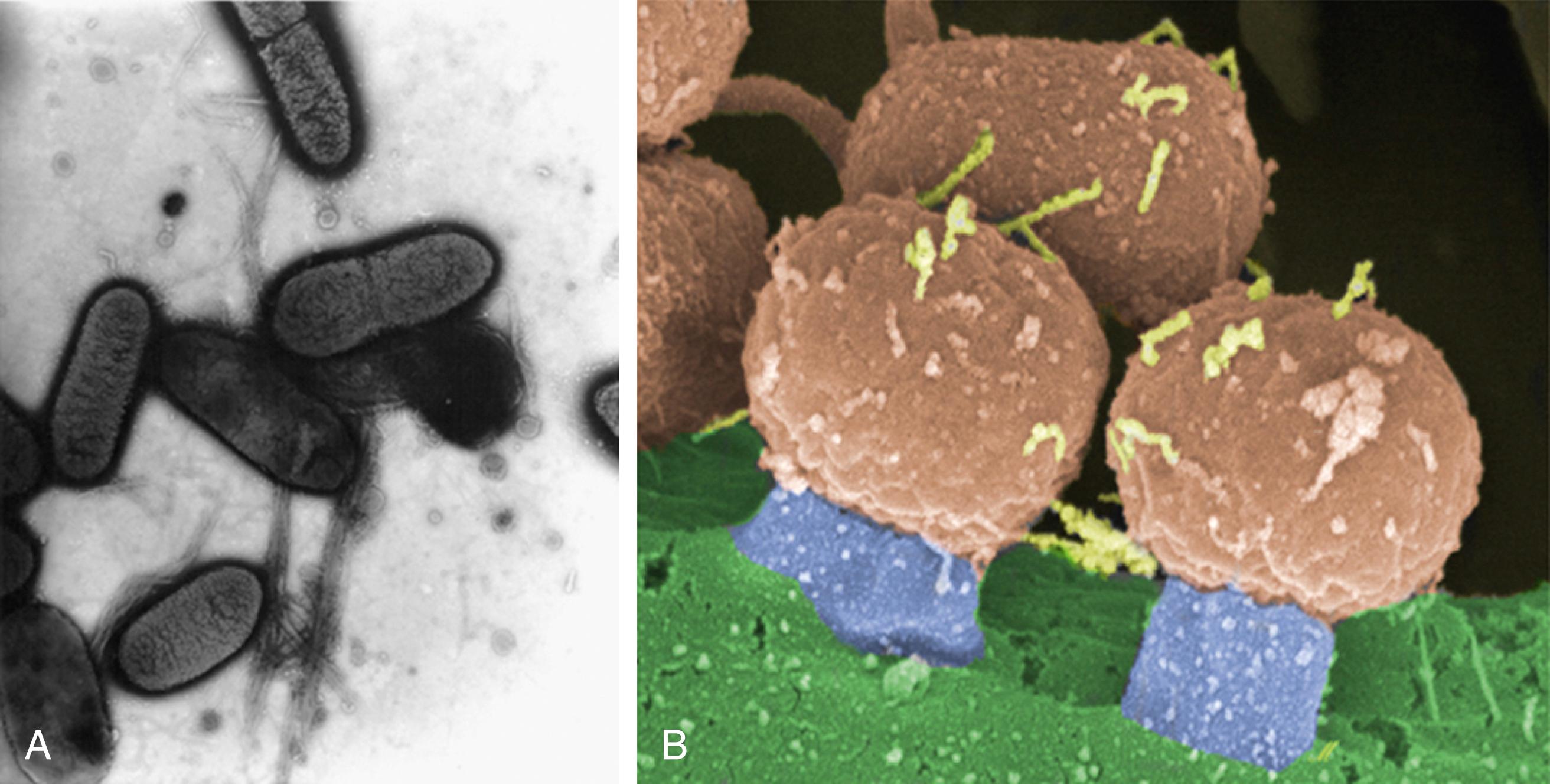 Fig. 110.1, A, Electron micrograph of EPEC and the characteristic bundle-forming pilus. B, Electron micrograph of EPEC adherent to a cell and demonstrating the attaching and effacing lesion, also called pedestal formation . EPEC ( brown ), pedestal ( blue ), cell ( green ).