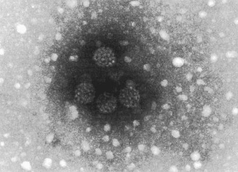 Fig. 18.16, Plantar wart: this honeycomb arrangement of HPV is characteristic.