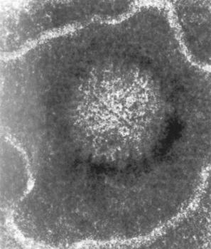 Fig. 18.34, Herpes virus: all members of the herpes virus group have identical ultrastructural morphology. Note the outer membrane surrounding the virus core. The herpes virus is an icosahedron with 162 capsomeres on its surface.