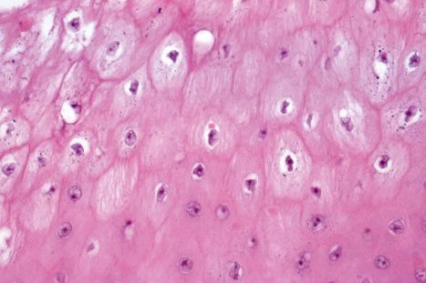 Fig. 18.73, Orf: in the center of the field is an eosinophilic intracytoplasmic inclusion.