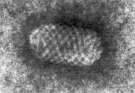 Fig. 18.75, Orf: on electron micrographic examination the parapoxvirus has a cylindrical appearance and a typical criss-crossed internal structure.