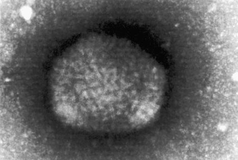 Fig. 18.76, Molluscum contagiosum: electron micrographic examination shows that the molluscum virus body is composed of virions, which are indistinguishable from those in the other poxviruses.