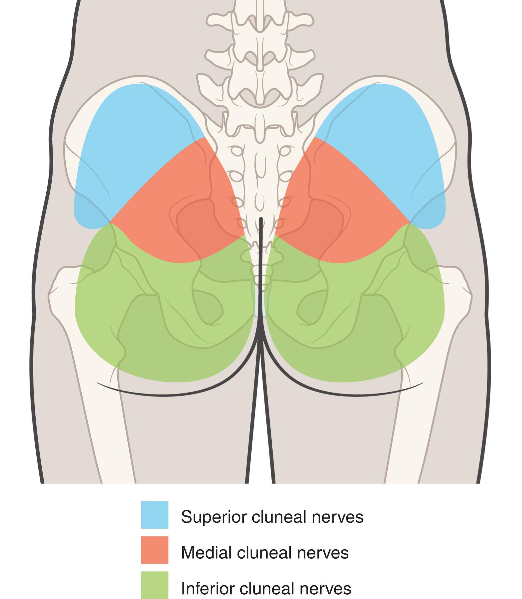 Figure 21.2, Cutaneous distribution of the inferior cluneal nerve.