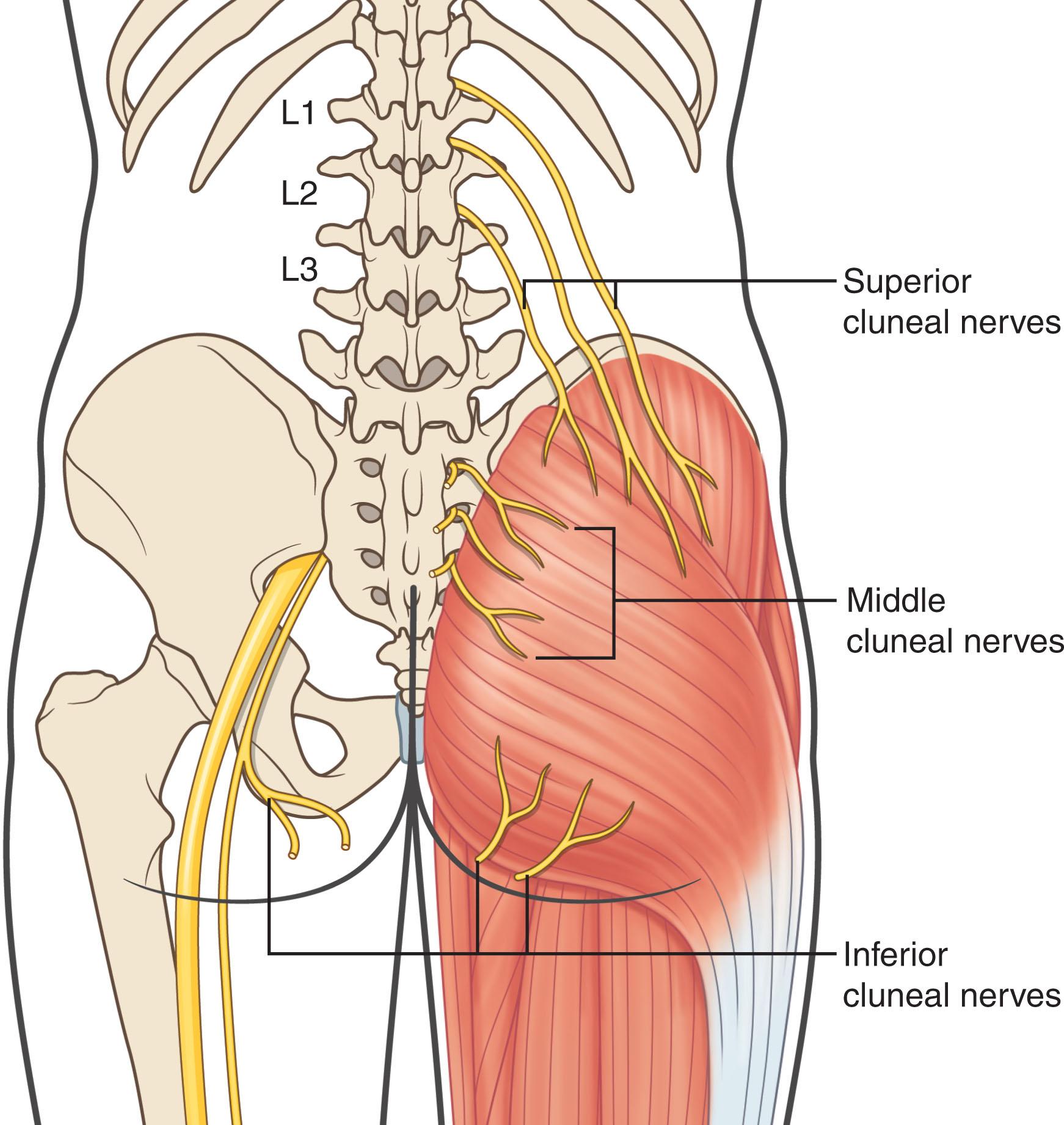 Figure 21.3, Anatomical location of the inferior cluneal nerve.