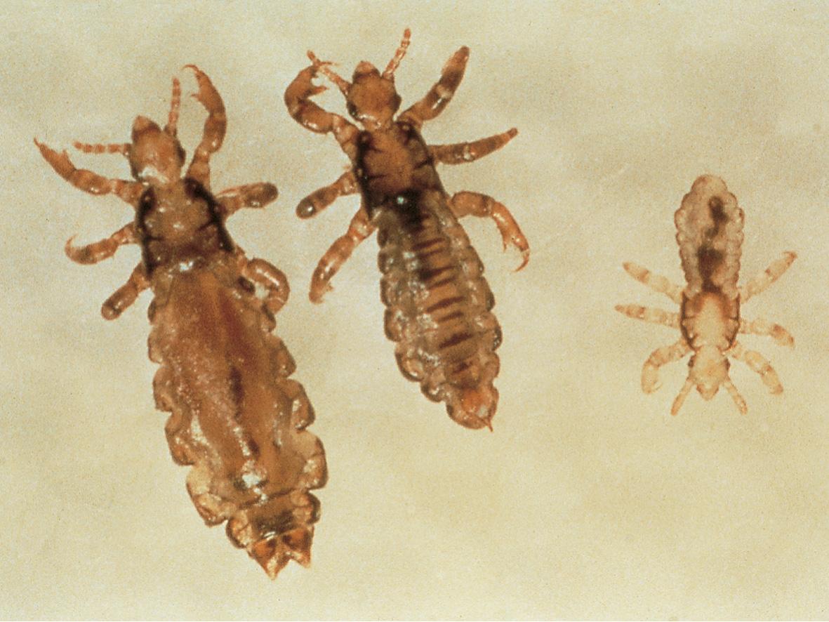 Fig. 84.7, Head louse family.