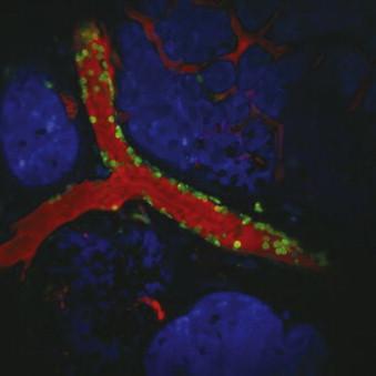 Figure 19-3, Live images of the tumor microenvironment of metastasis (TMEM) in a mouse breast carcinoma