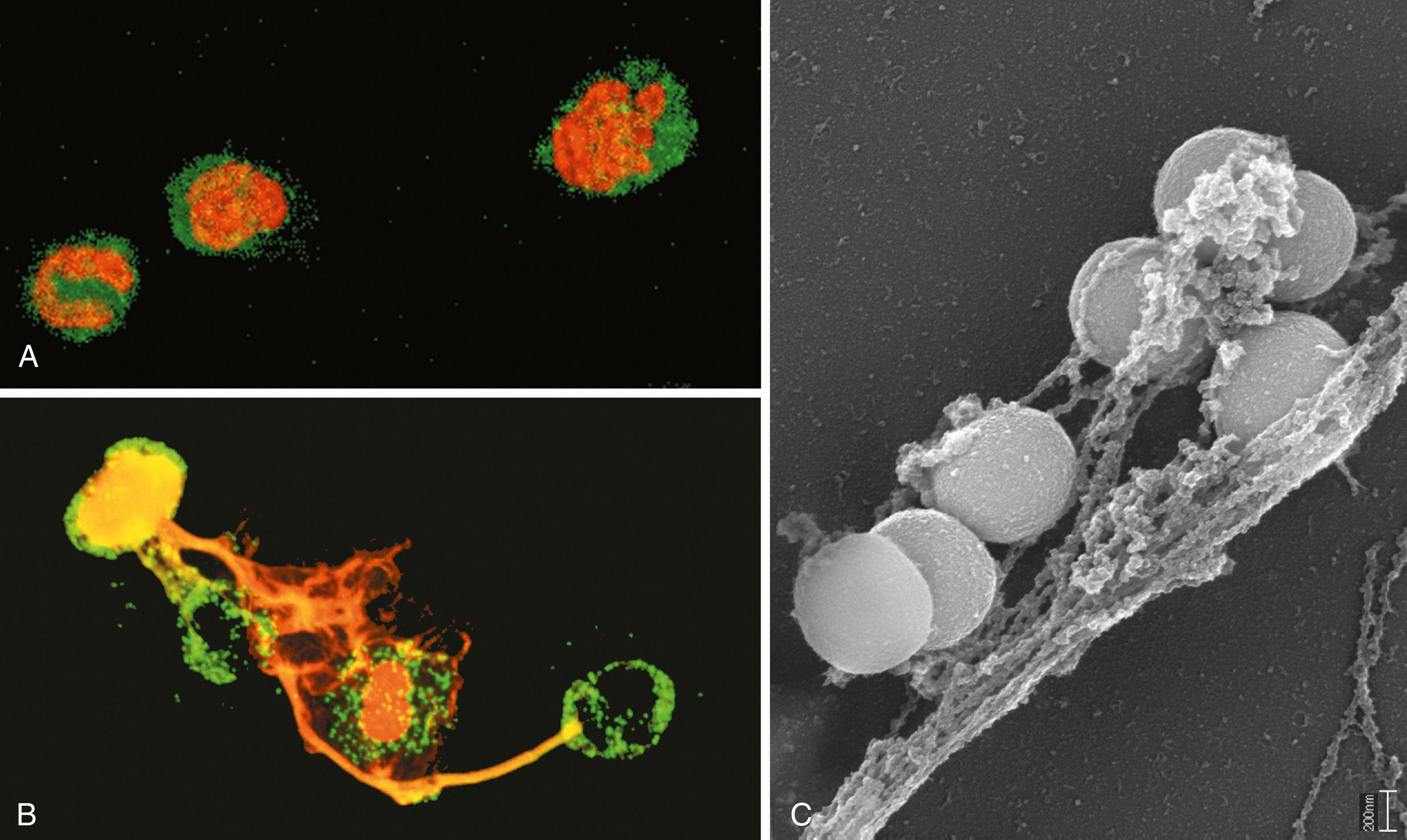 eFIG. 2.2, Neutrophil extracellular traps (NETs). (A) Healthy neutrophils with nuclei stained red and cytoplasm green. (B) Release of nuclear material from neutrophils (note that two have lost their nuclei), forming extracellular traps. (C) An electron micrograph of bacteria (staphylococci) trapped in NETs.