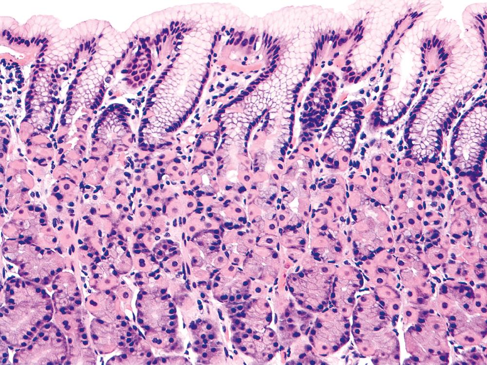 FIGURE 15.1, The normal superficial foveolar (neck) region of the gastric body contains rare or no mononuclear cells and no neutrophils.