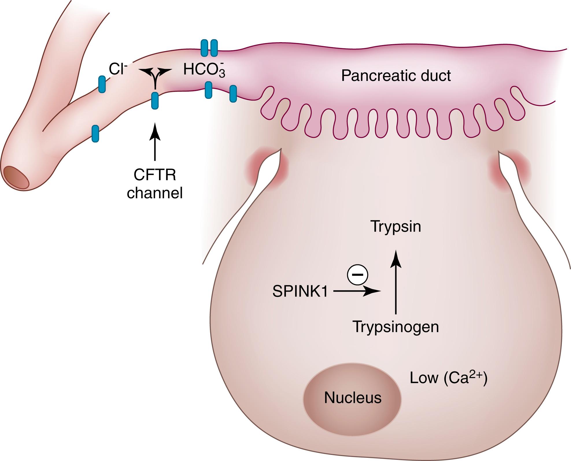 FIGURE 40.8, Mutations in PRSS1 (trypsinogen gene), SPINK1, and CFTR (a gene involved in cystic fibrosis) have been implicated in pancreatitis. Activation of trypsinogen to trypsin is a key event in the initiation of pancreatitis and is inhibited by SPINK1 . Mutations in CFTR result in decreased luminal secretion of chloride ion (Cl − ), which ultimately results in reduced surface fluid in the ducts. Ca 2+ , calcium ion; HCO 3 − , bicarbonate ion.