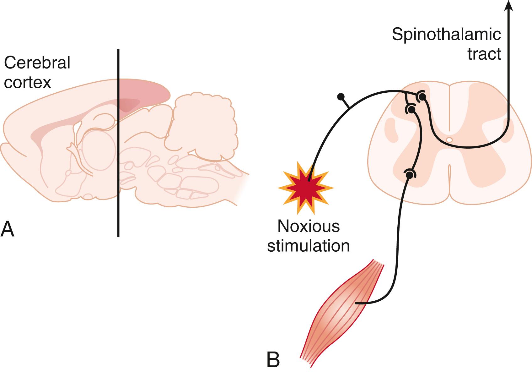 Fig. 19.4, Inhaled anesthetics produce immobility at the spinal level. (A) Decerebration by removal of the forebrain rostral to the black line does not alter the minimum alveolar concentration of isoflurane in rats, indicating that volatile anesthetic immobilization does not depend on the cerebral cortex. 28 29 (B) Anesthetics suppress the nocifensive withdrawal reflex response to noxious stimulation transmitted to the dorsal horn by sensory nerves at the spinal level. Current efforts are focused on identifying the molecular, cellular, and anatomic substrates for this effect.