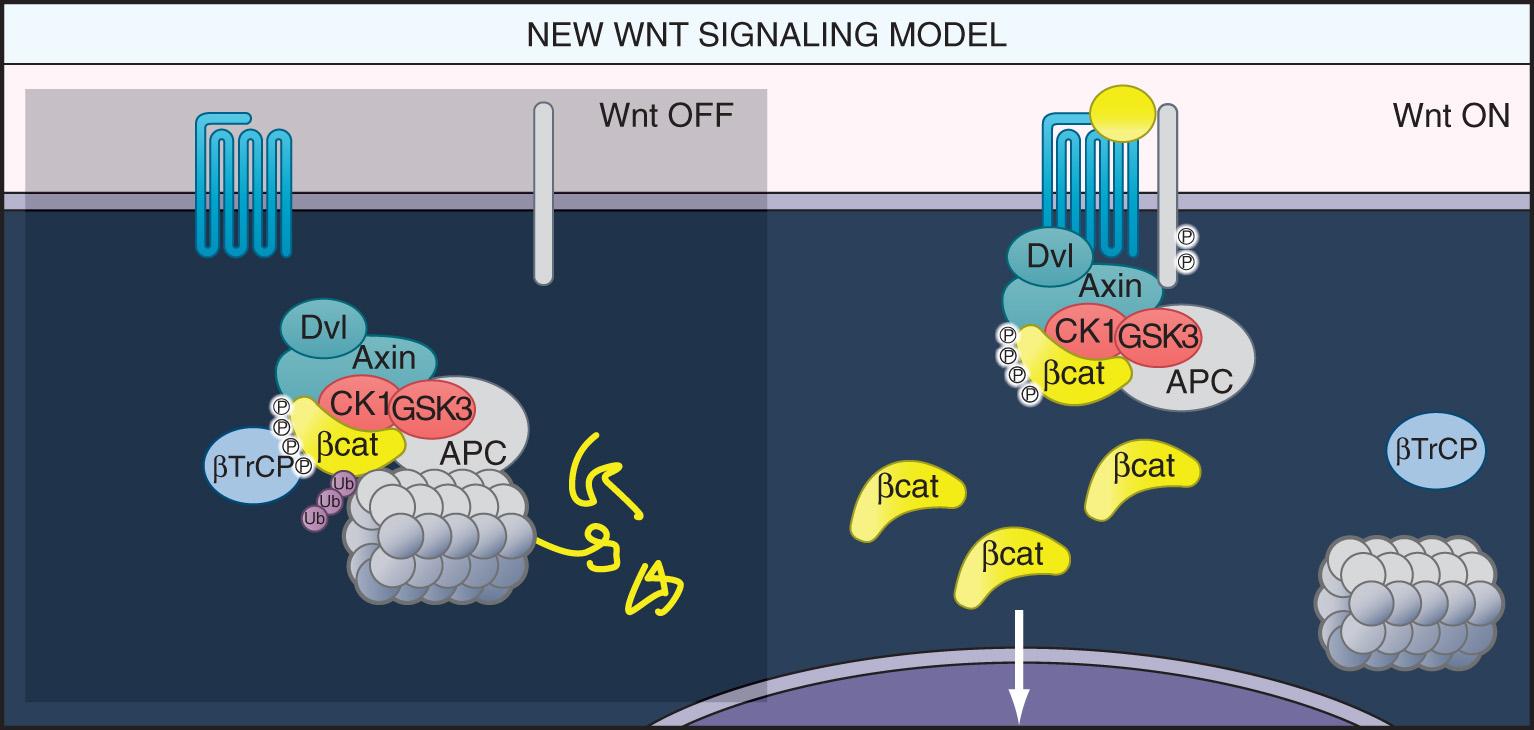 FIGURE 165.2, Wnt signaling. On the left , when there is no Wnt ligand interacting with the 7-transmembrane spanning receptor (unnamed here but termed “frizzled” in lower organisms), Wnt signaling is off, APC interacts with β-catenin leading to its phosphorylation and degradation, and the proliferative program is inactive. ( Wnt derived its name from a conflation of the wingless gene in flies–wt—and the Int-1 proto-oncogene; there are 19 human Wnt genes.) On the right , the yellow Wnt ligand is secreted by an adjacent cell, binds to the receptor complex, which prevents APC from interacting with β-catenin, permitting its intracellular concentration to rise, triggering a growth program and inhibiting the differentiation program. 4 Dysregulation of Wnt signaling is seen in almost all colorectal neoplasms, and germline mutations in APC cause FAP. β-cat , β-catenin; βTrCP , β-transducin repeats-containing proteins (a ubiquitin ligase subunit involved in the degradation of β-catenin in the proteasome); APC , adenomatous polyposis coli gene; Axin , part of the APC-containing complex; CK1 , casein kinase-1 (together with GSK3, phosphorylates β-cat at multiple sites, which leads to its destruction); Dvl , disheveled; GSK3 , glycogen synthase kinase-3.
