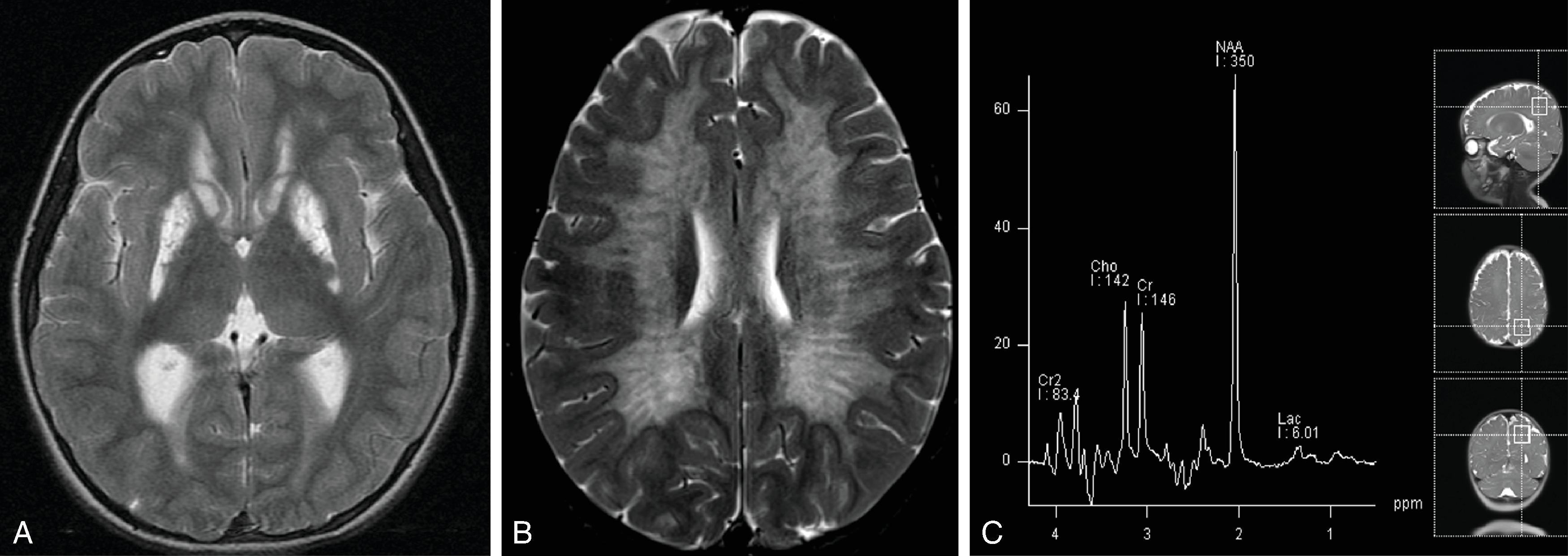 Fig. 4.1, Examples of Metabolic Disorders .