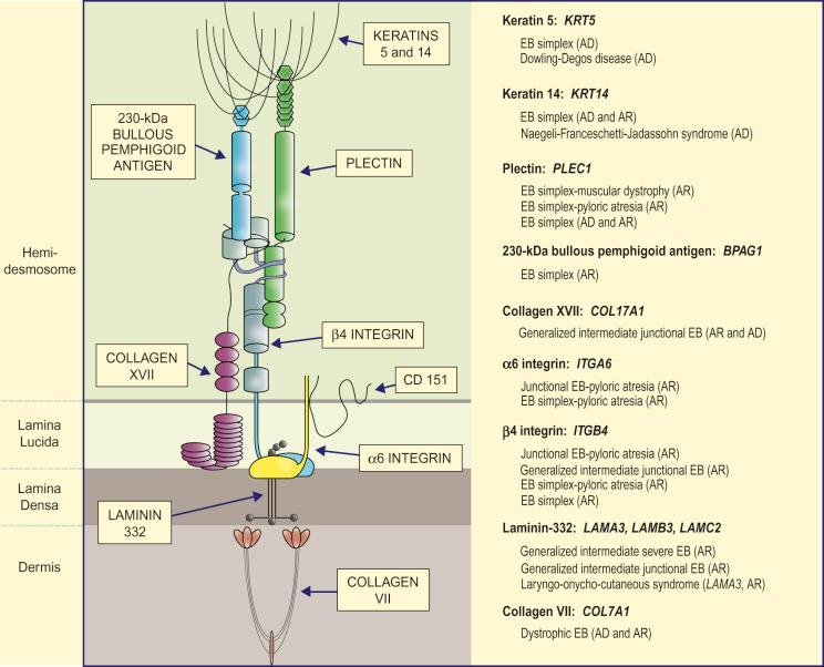 Fig. 4.9, Schematic representation of the major adhesive proteins within hemidesmosome adhesion complexes at the dermal–epidermal junction and their involvement in different types of EB. (AD = autosomal dominant; AR = autosomal recessive).