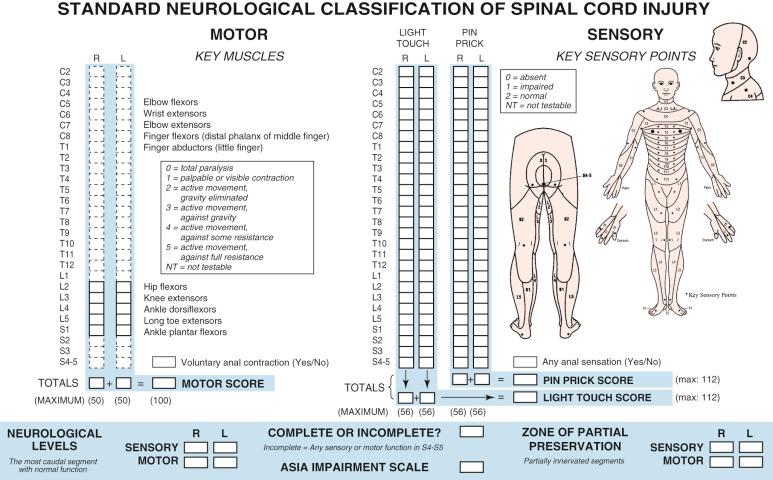 Fig. 11.2, The American Spinal Injury Association (ASIA) neurological classification of spinal cord injury and the ASIA impairment scale are useful tools for precisely mapping motor and sensory deficits to a specific spinal cord level.