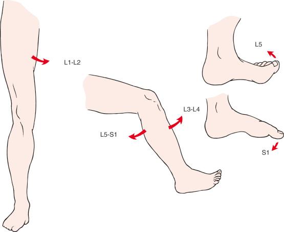 Fig. 11.4, Examination of muscle groups innervated by nerve roots in the lower extremity should include leg abduction (L2), knee extension (L3), ankle dorsiflexion (L4), great toe extension (L5), and great toe flexion (S1).