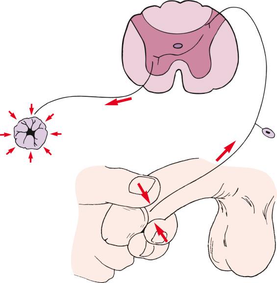 Fig. 11.5, The bulbocavernosus reflex is tested by squeezing the glans penis or tugging on an indwelling Foley catheter and looking for contraction of the external anal sphincter. This reflex is mediated by the S1, S2, and S3 nerve roots.