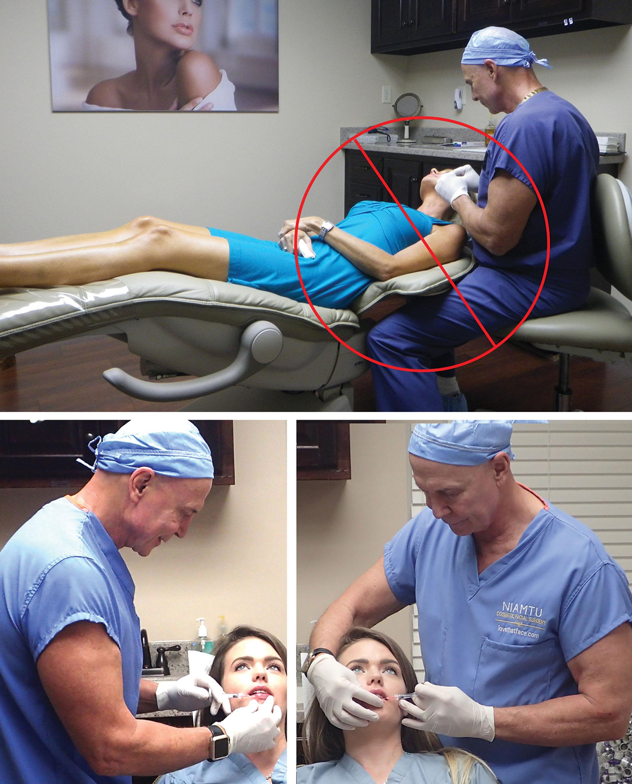 Fig. 10.14, Not injecting in the supine position and injecting on both sides of the patient are considered important by the author (JN).